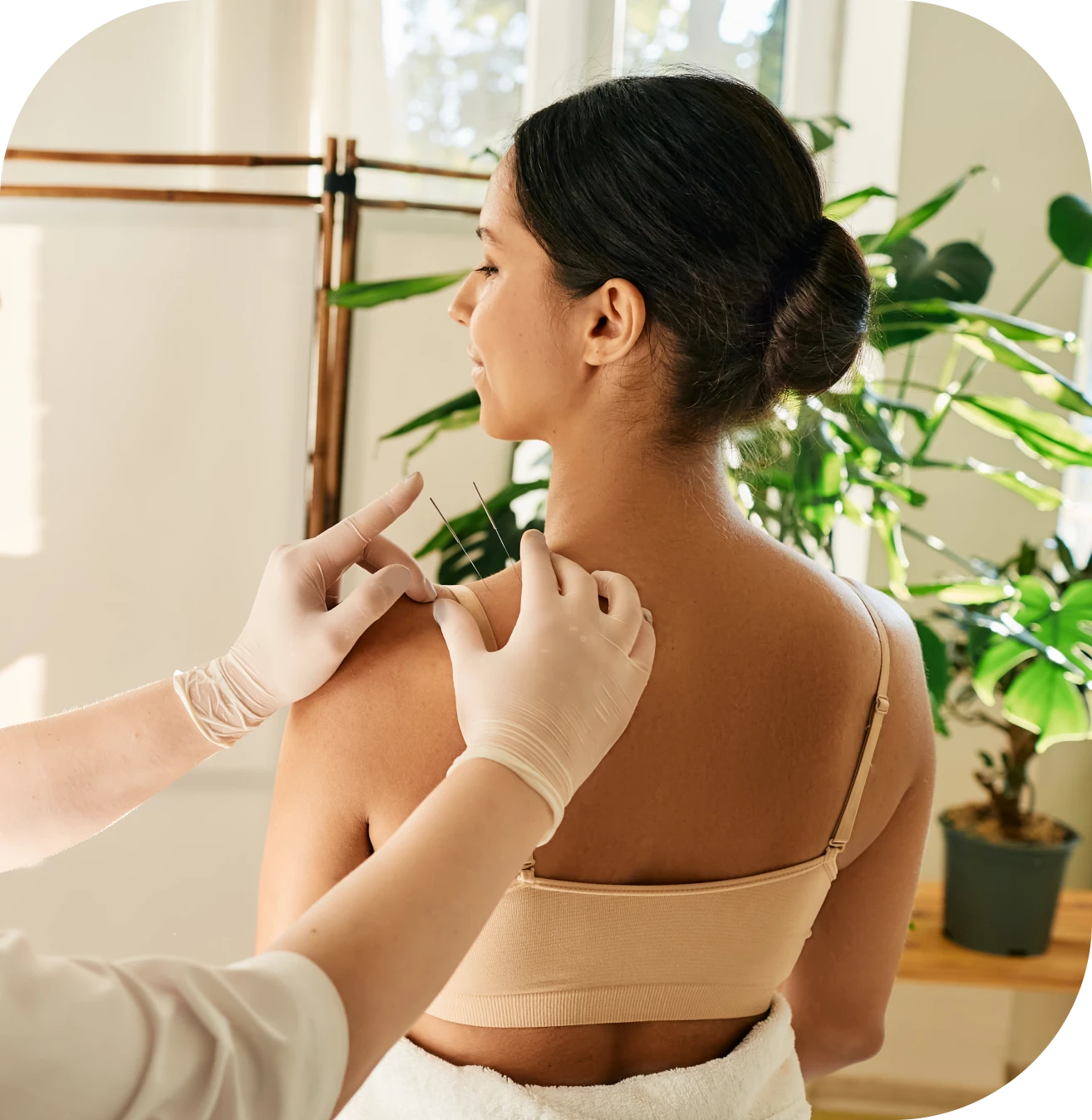 Woman receiving acupuncture treatment on shoulder