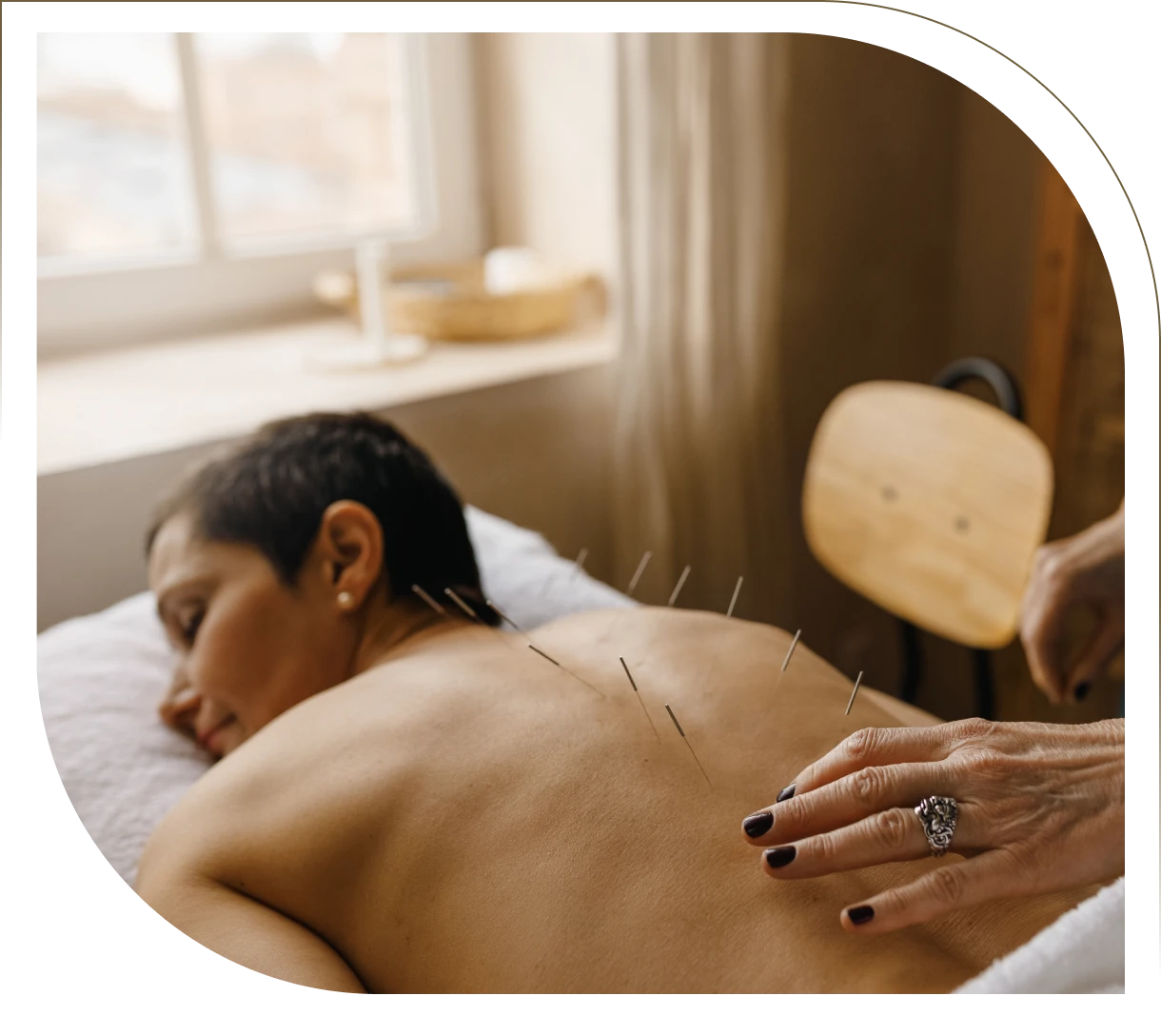 Relaxing treatment with acupuncture needles
