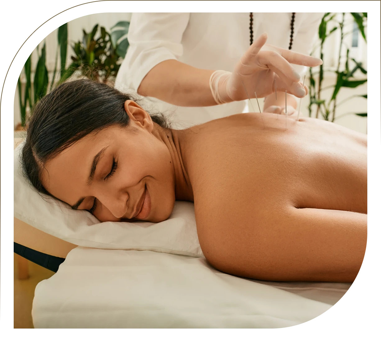 Relaxing acupuncture session
